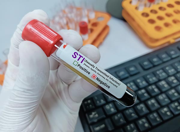 Gloved hand of a lab technician holding an STI test tube with red cap, labeled for positive or negative results. Background shows keyboard and test tube rack.